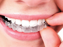 young woman with healthy white teeth taking out braces
